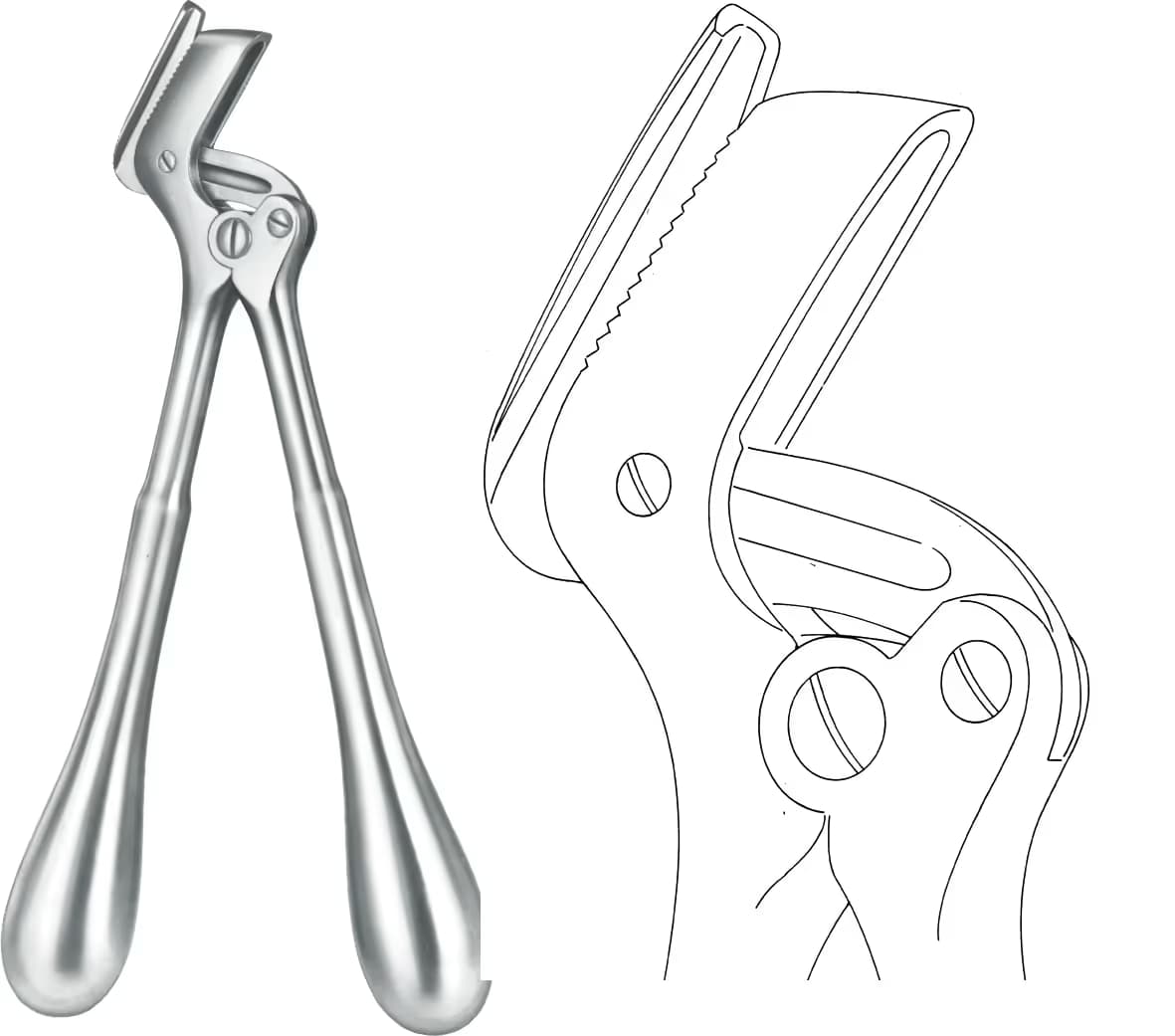 ALÇI AYIRICI STILLE 26CM